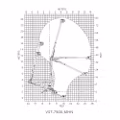 2026 Versalift VST-7500-MHN - Image 2